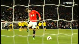 Manchester United Vs Sunderland Penalty Shootout 220114 [upl. by Center]