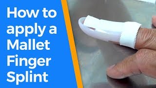 How to splint a mallet fingerfinger splints [upl. by Ynnavoj]