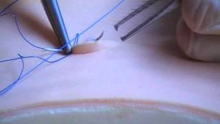 Subcuticular Suture Technique [upl. by Alix]