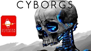 Cyborgs [upl. by Sidwell]