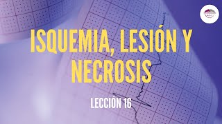 16 ELECTOCARDIOGRAMA ISQUEMIA LESIÓN Y NECROSIS ELECTROCARDIOGRAFÍA [upl. by Ellerud]