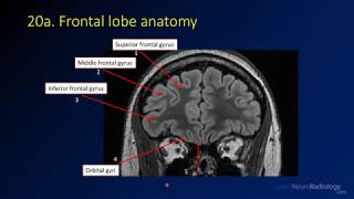 Neuroradiology review  brain gyral anatomy [upl. by Weiler56]