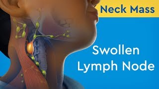 Axillary Lymph Nodes Dr Adel Bondok [upl. by Ytsud922]