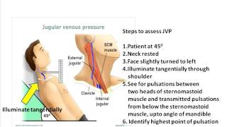 Jugular venous pulse clinical aspects [upl. by Colyer358]