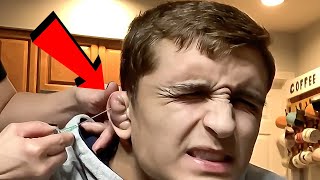 Draining A Cauliflower Ear [upl. by Zigrang]