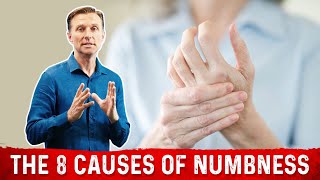 The 8 Causes of Numbness in the Body [upl. by Yeaton]