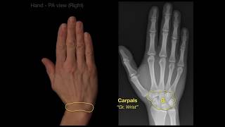 Anatomy of Hand XraysRevised [upl. by Thatch]