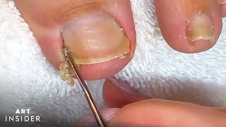 How Toenails Are Professionally Cleaned [upl. by Reinhart]