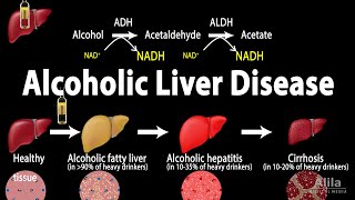 Alcoholic Liver Disease Animation [upl. by Atnahsa]