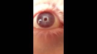 ojos albinos con nistagmo [upl. by Euridice233]