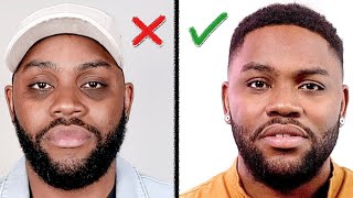 Remove DARK CIRCLES Under Your Eyes How I Did It Mens Skin Care [upl. by Winzler432]