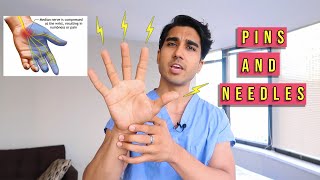 What Causes Pins and Needles in Hand at Night  Paresthesia [upl. by Elrae]