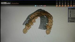 Zirkonzahn system implant type screw retained full arch Prettau [upl. by Ecinnej]