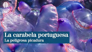 La peligrosa picadura de la carabela portuguesa [upl. by Crenshaw]