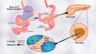 How tyrosine might help regulate glucose levels [upl. by Berlauda945]