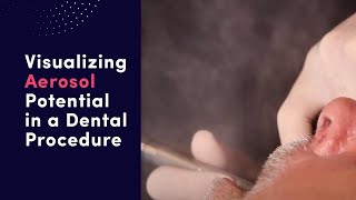 Visualizing Aerosol Potential in a Dental Procedure [upl. by Major]