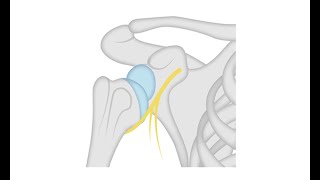 Diagnosing a shoulder dislocation [upl. by Highams816]