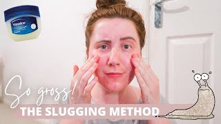 I Tried SLUGGING For A Week With ACNE Prone Skin [upl. by Nauqahs]