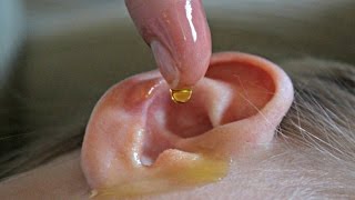 745  Infected Swollen Ear Wax Removal [upl. by Ahsilif]