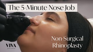 The 5Minute Nose Job 🟡 The NonSurgical Rhinoplasty by VIVA Skin Clinics [upl. by Cully]