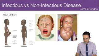 Infectious vs NonInfectious Disease [upl. by Valaree392]