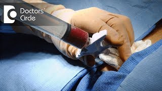 Allogeneic stem cell transplant discharge longterm followup care [upl. by Aldon]