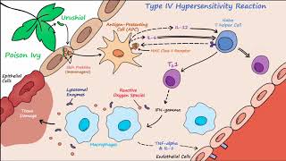 Type IV Hypersensitivity Described Concisely [upl. by Glassman]