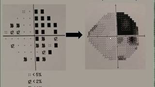 Visual Perception – How It Works [upl. by Statis]