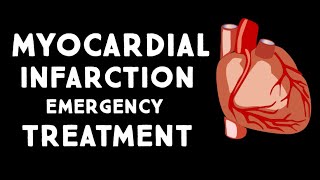 Myocardial Infarction MIHeart Attack Treatment in Emergency  Step wise STEMI Management USMLE [upl. by Dudley863]