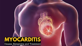 Myocarditis Causes Signs and Symptoms Diagnosis Treatment [upl. by Novar381]