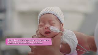 Premature baby  Nutrition and feeding [upl. by Slemmer]