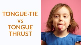 TongueTie vs Tongue Thrust  Whats The Difference [upl. by Namilus796]