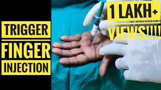 Trigger Finger Injection Technique [upl. by Loise]