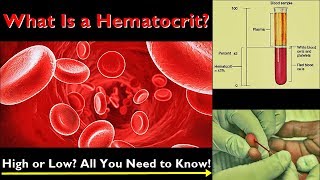 Hematocrit – Normal Range Low and High Levels Causes [upl. by Lindblad]