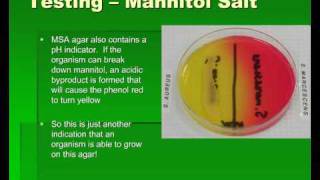 Introduction to Streptococcus [upl. by Sherwynd]