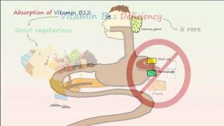 Megaloblastic Anemia Part 1 Vitamin B12 Deficiency Anemia [upl. by Lamoree]