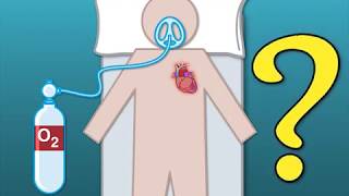 Cardiac Contractility Modulation  Mode of Action English [upl. by Alano]