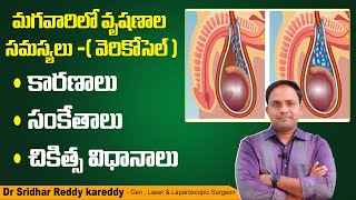 వెరికోస్ ఎగ్జిమా అంటే ఏమిటి  Causes and Treatment for Varicose Eczema  Dr Anand Hair And Skin [upl. by Yeleek]