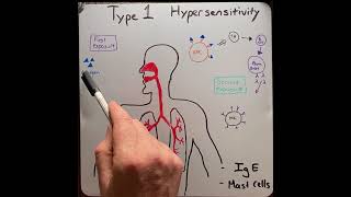 Type I hypersensitivity reaction in 2 mins [upl. by Biel768]