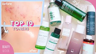 Best Toners for Acne Hyperpigmentation Large Pores Whiteheads amp Blackheads [upl. by Nanahs]