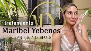 TRATAMIENTO JOVENA MARIBEL YEBENES  DOLLACTITUD [upl. by Garrity]