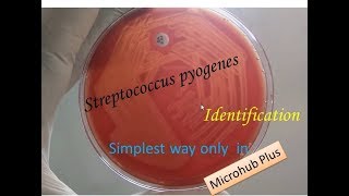 Streptococcus pyogenes identification [upl. by Carrie]