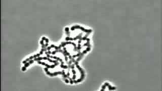 Bacteria Streptococcus pyogenes [upl. by Suertemed976]