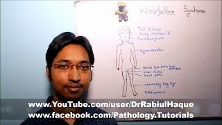 Klinefelter Syndrome  Part 1 HD [upl. by Noet225]