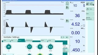 RT Clinic  Neonatal Oscillatory Ventilation [upl. by Ecertak]