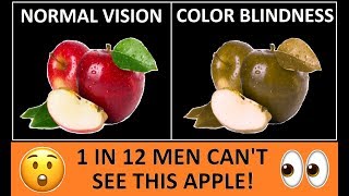 Types of Color Blindness  Color Vision Deficiency [upl. by Janith]