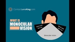 Monocular Vision Impairment and How it Impacts Depth Perception [upl. by Rossen]