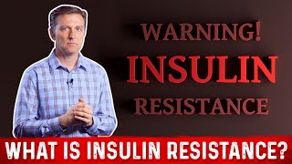 What Is Insulin Resistance – Dr Berg [upl. by Lowney312]