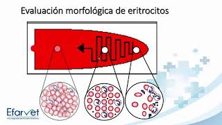 Eritrocito y alteraciones morfológicas [upl. by Nevanod]