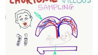 Chorionic Villus Sampling CVS Mnemonic [upl. by Kcirdor462]